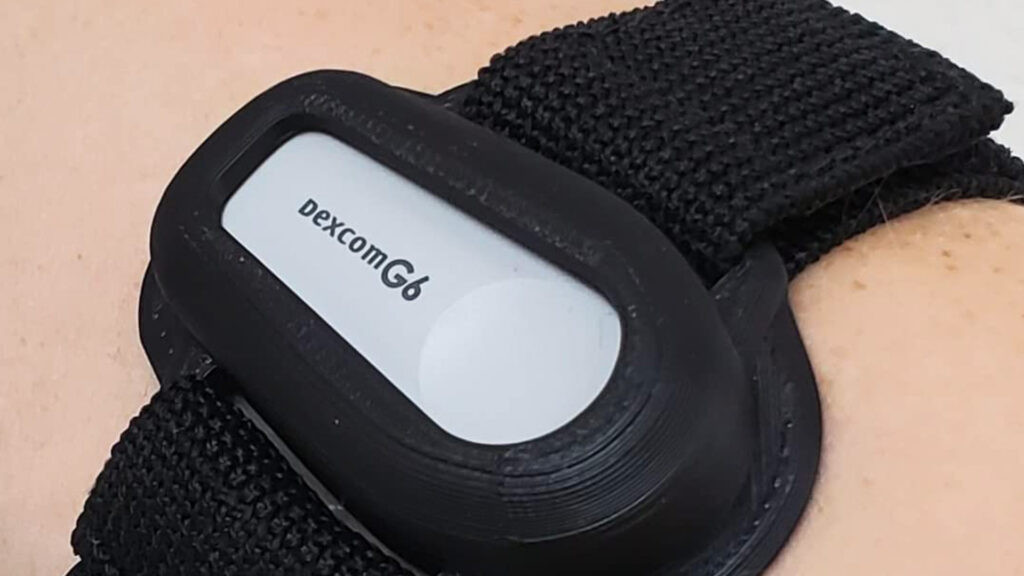 Dexcom G6 CGM arm band for sensor protection during activities